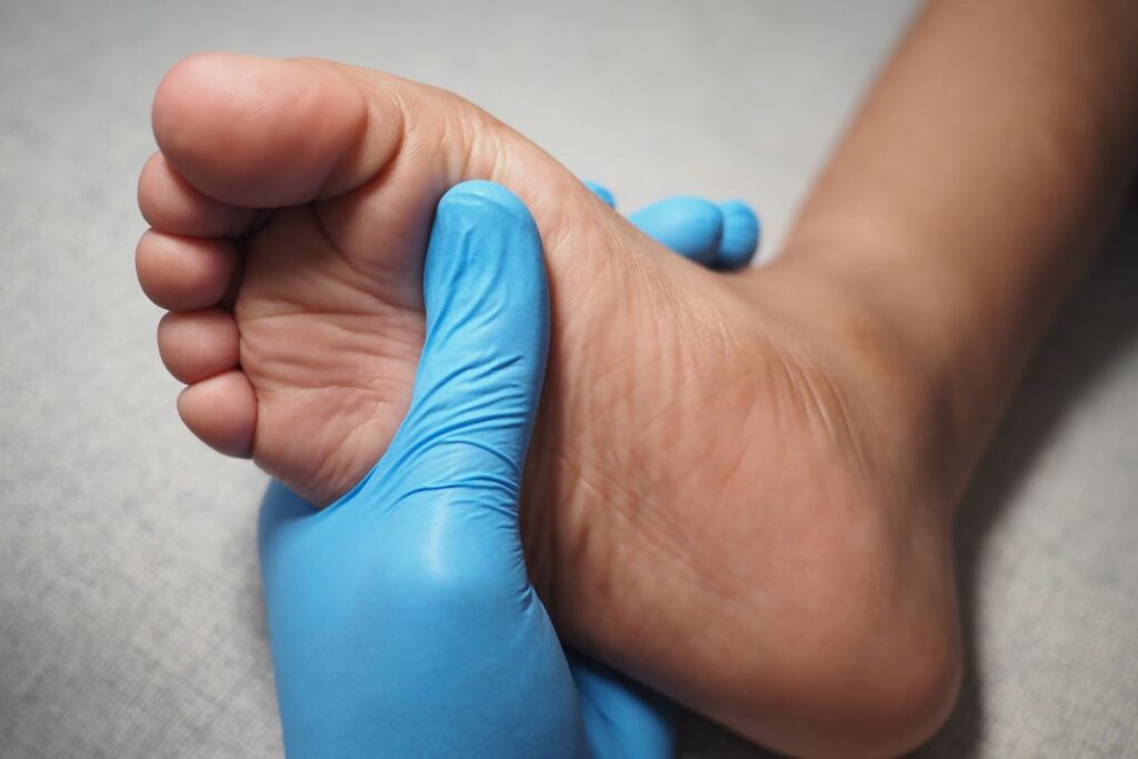 soigner une bursite au pied 