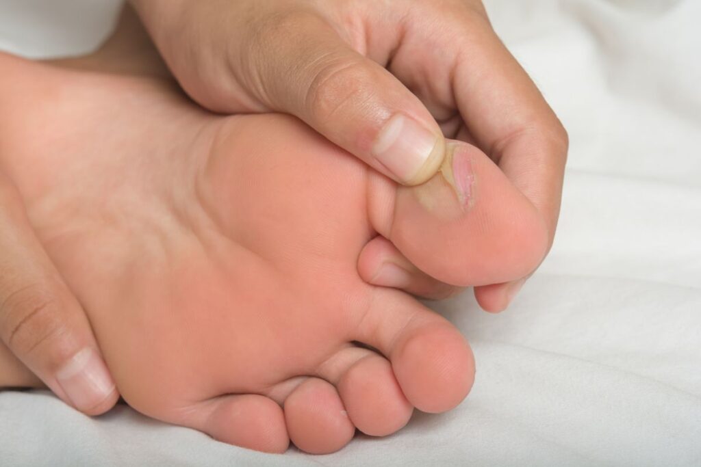 percer les ampoules au pied 