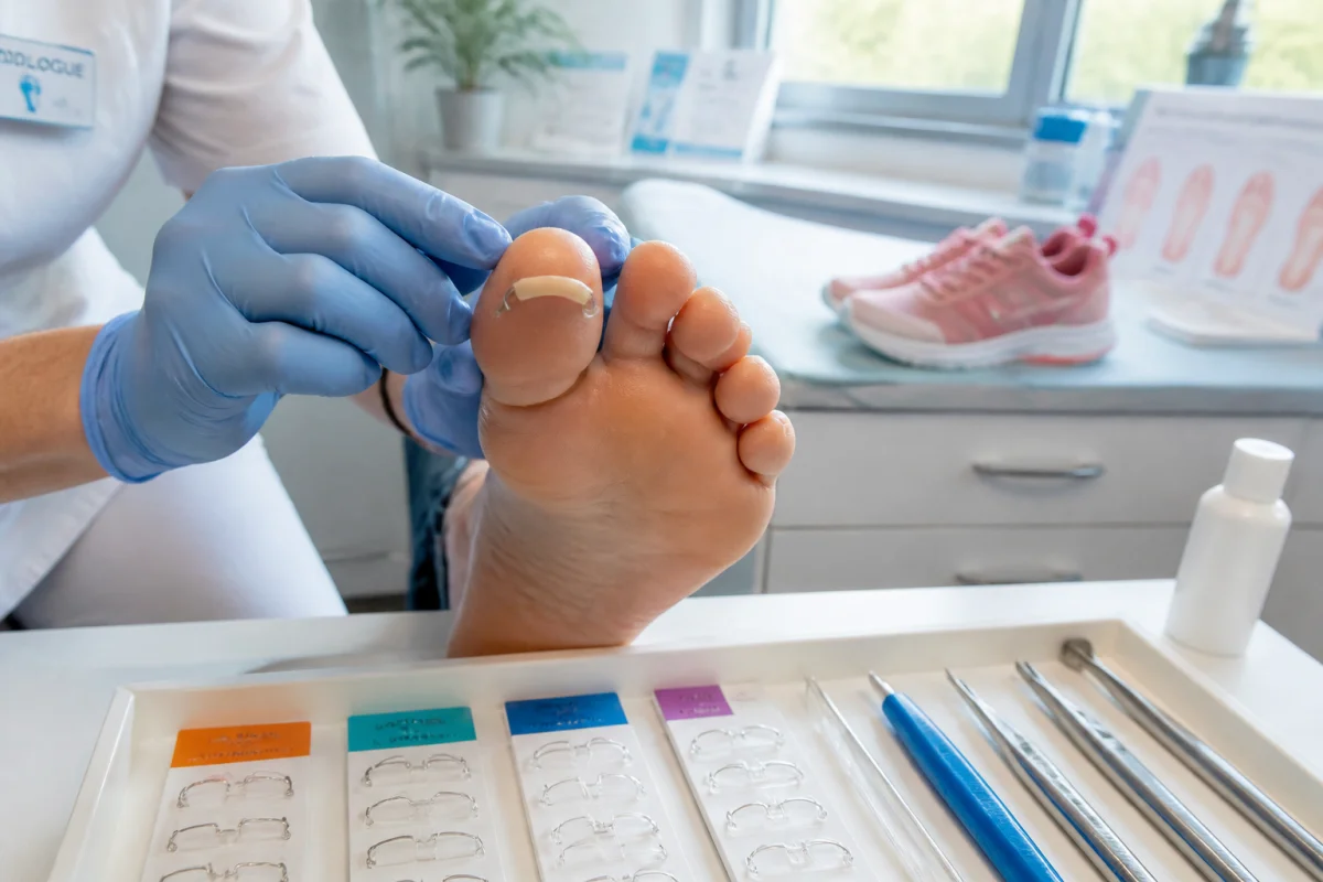 Comment redresser un ongle en tuile durablement